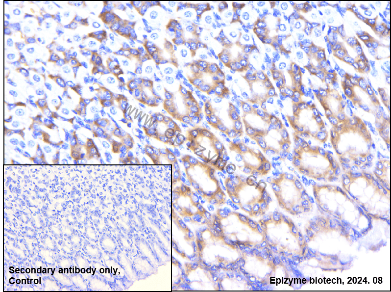 Anti-Phospho-eIF4B (Ser406) Rabbit mAb [73L05M48]