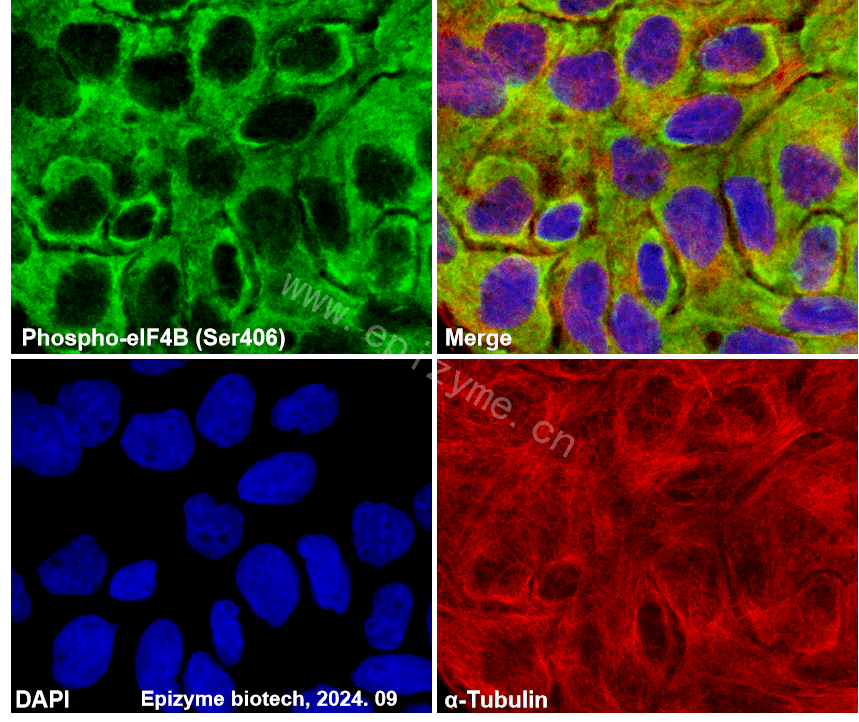 Anti-Phospho-eIF4B (Ser406) Rabbit mAb [73L05M48]