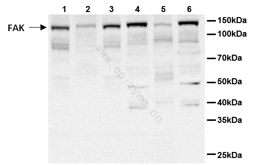 Anti-FAK Rabbit mAb [56K44M73]