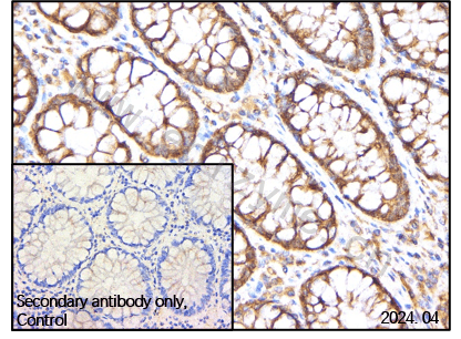 Anti-FAK Rabbit mAb [56K44M73]