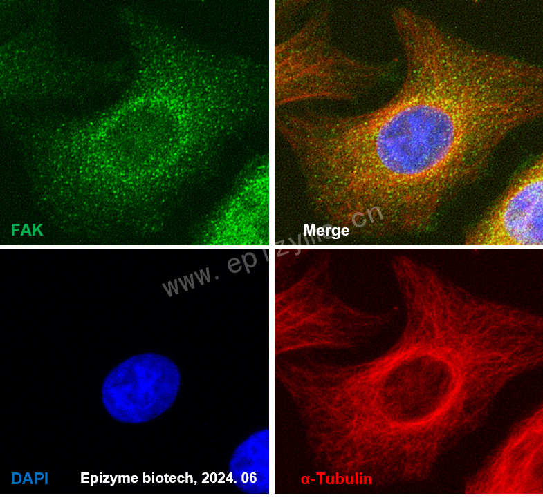 Anti-FAK Rabbit mAb [56K44M73]