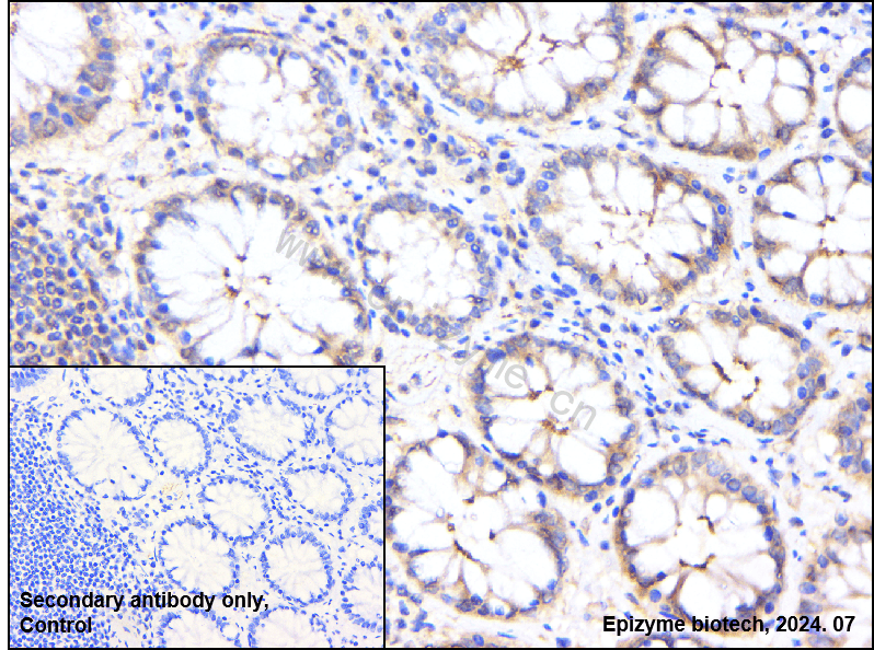 Anti-SODD Rabbit mAb [27L02K03]