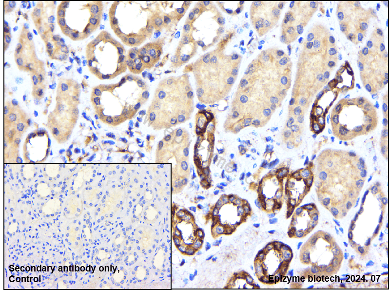 Anti-SODD Rabbit mAb [27L02K03]