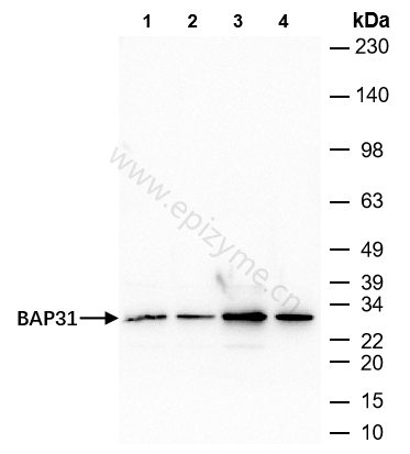 Anti-BAP31 Rabbit mAb [10M17K95]