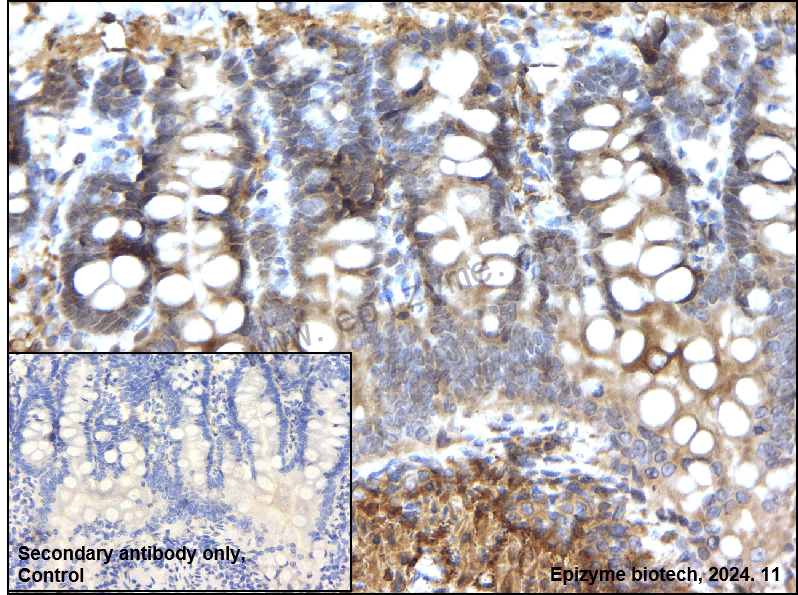 Anti-BAP31 Rabbit mAb [10M17K95]