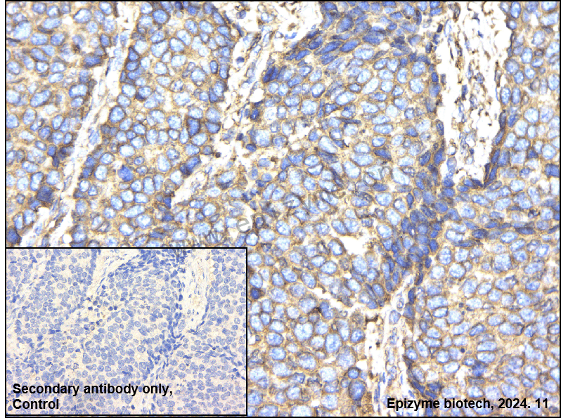 Anti-BAP31 Rabbit mAb [10M17K95]