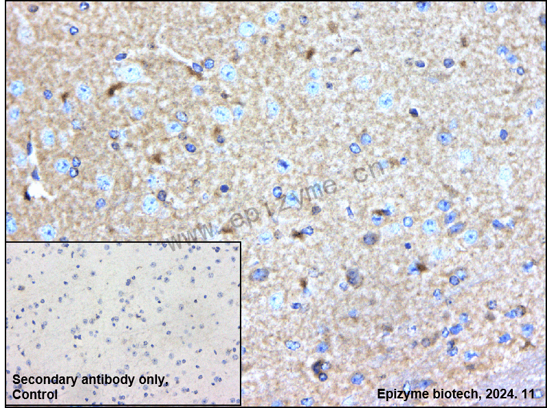 Anti-BAP31 Rabbit mAb [10M17K95]