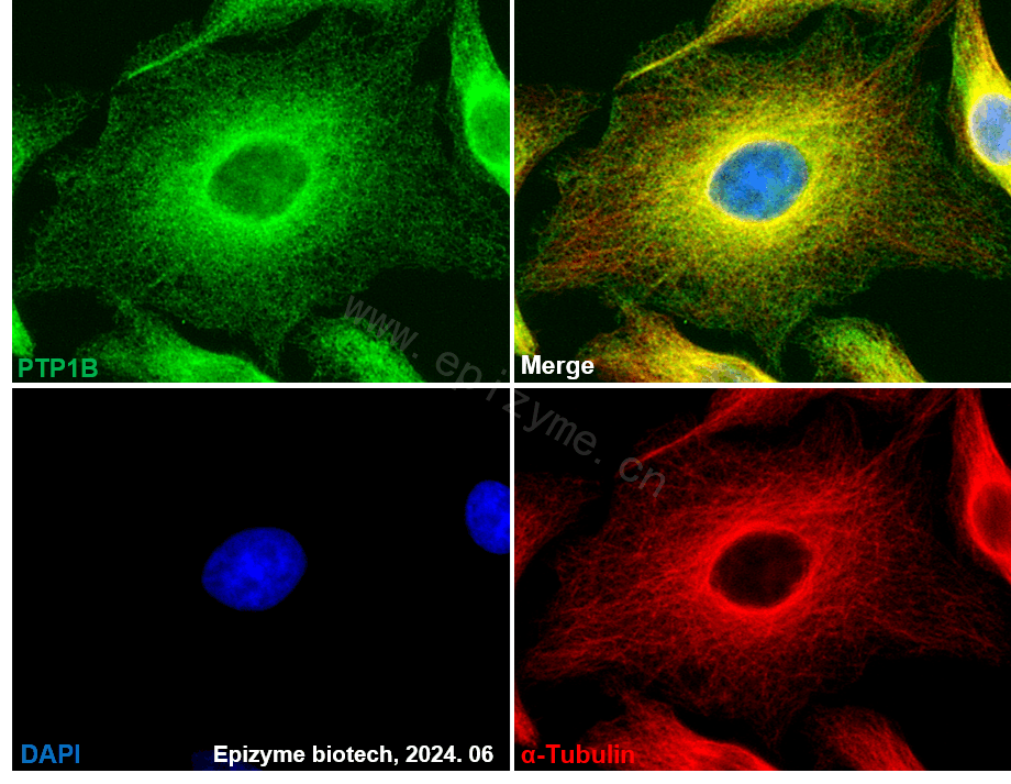 Anti-PTP1B Rabbit mAb [14M54K72]