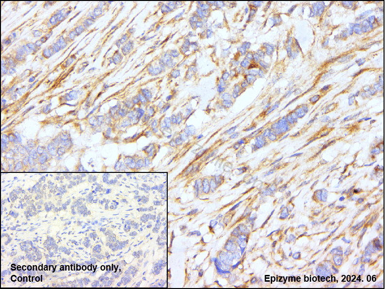 Anti-PTP1B Rabbit mAb [14M54K72]