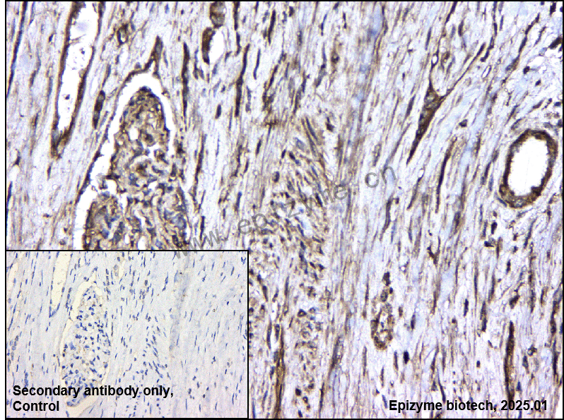 Anti-VEGFD Rabbit mAb [10M31K47]