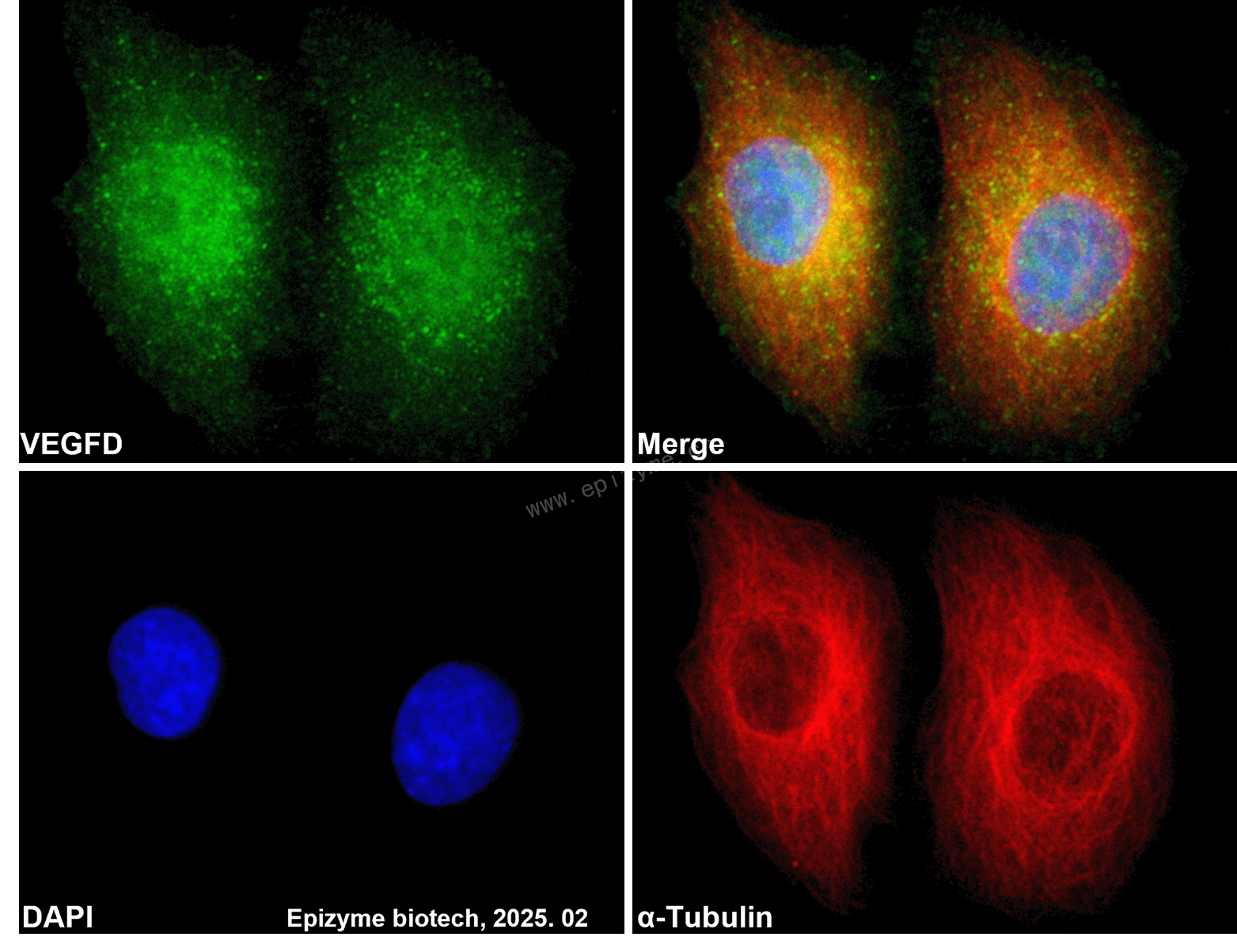 Anti-VEGFD Rabbit mAb [10M31K47]