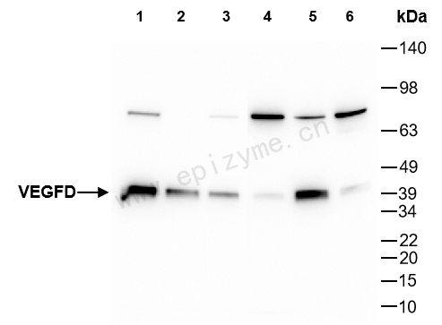 Anti-VEGFD Rabbit mAb [10M31K47]