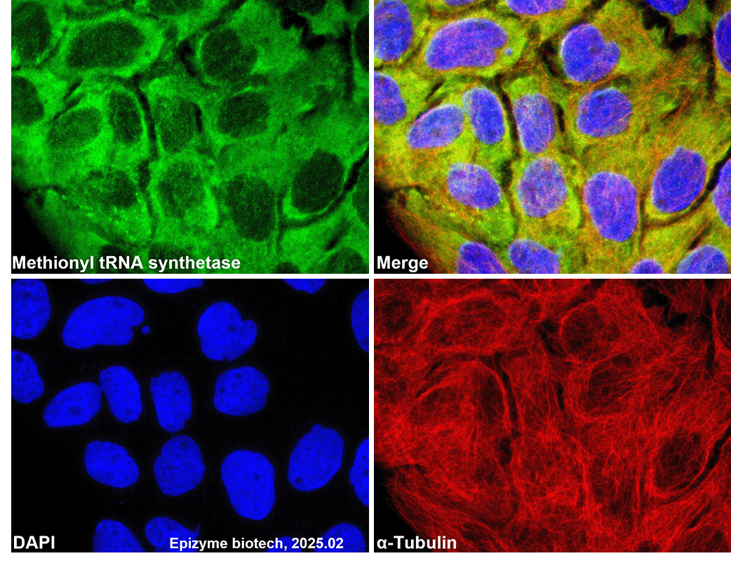 Anti-MetRS Rabbit mAb [63M16M17]