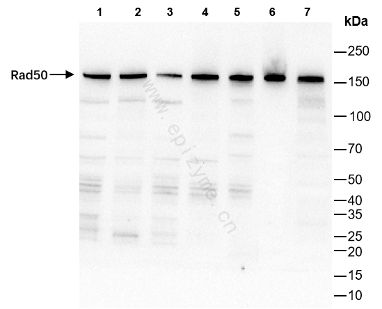Anti-Rad50 Rabbit mAb [14L64M75]