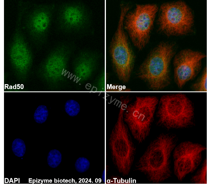 Anti-Rad50 Rabbit mAb [14L64M75]