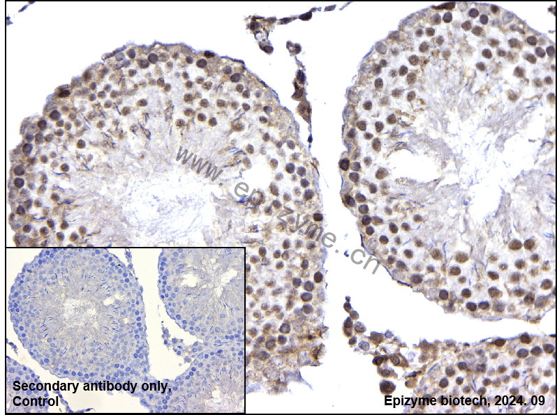 Anti-Rad50 Rabbit mAb [14L64M75]