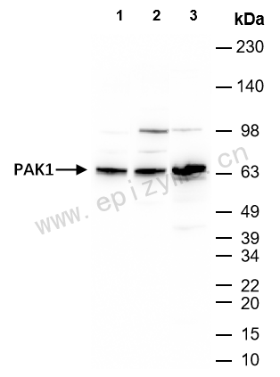 Anti-PAK1 Rabbit mAb [41M74L14]