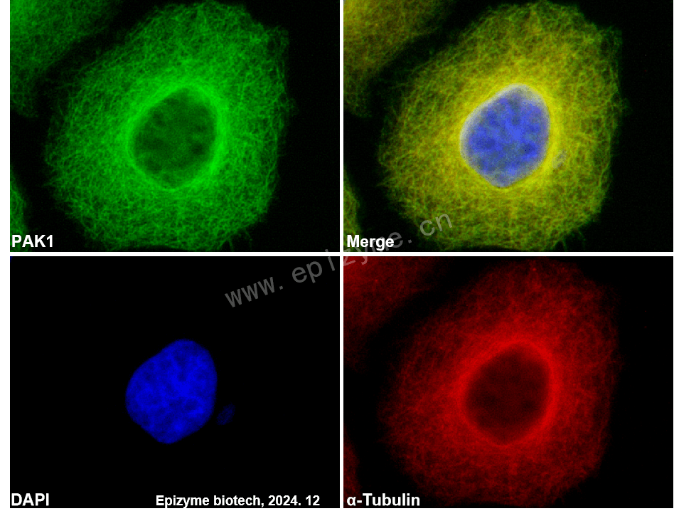 Anti-PAK1 Rabbit mAb [41M74L14]