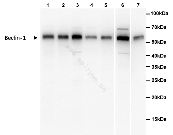Anti-Beclin 1 Rabbit mAb [41L08L42]