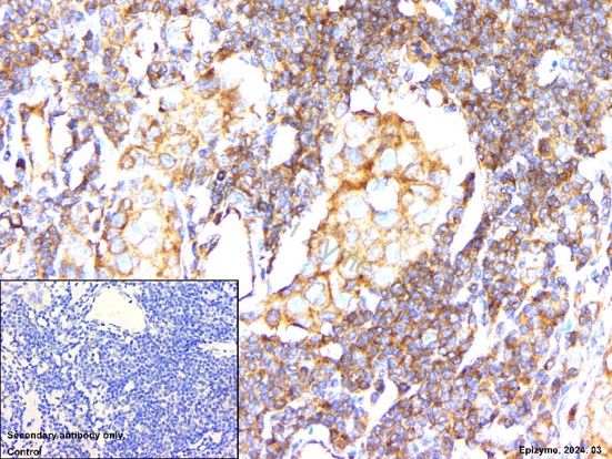 Anti-Beclin 1 Rabbit mAb [41L08L42]