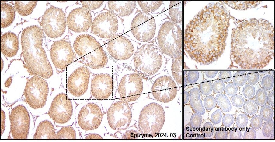Anti-Beclin 1 Rabbit mAb [41L08L42]