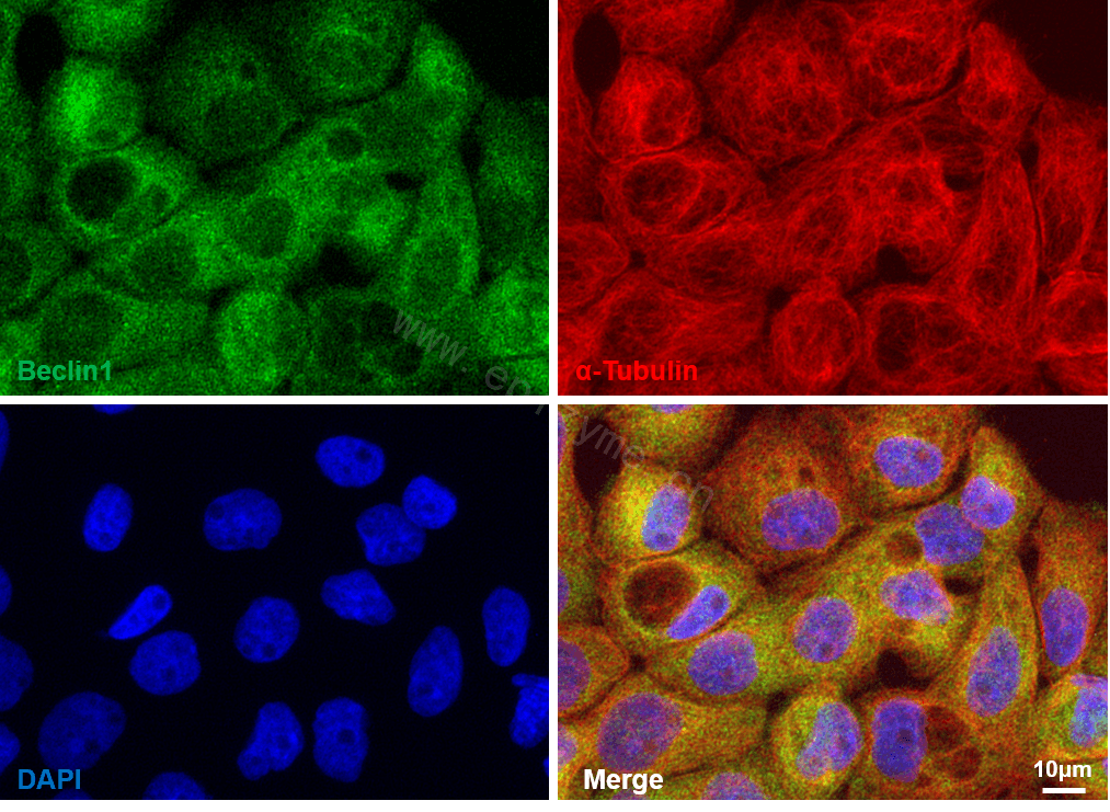 Anti-Beclin 1 Rabbit mAb [41L08L42]