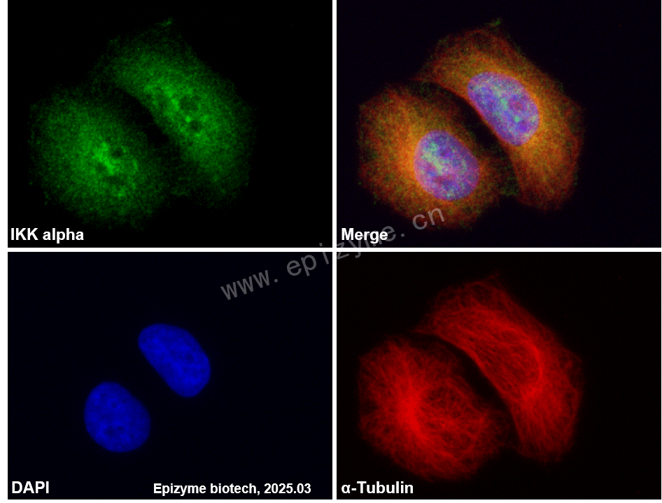 Anti-IKK alpha Rabbit mAb [50K42L84]