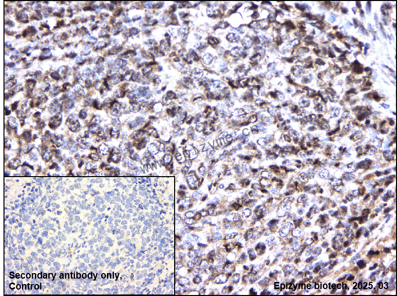 Anti-IKK alpha Rabbit mAb [50K42L84]