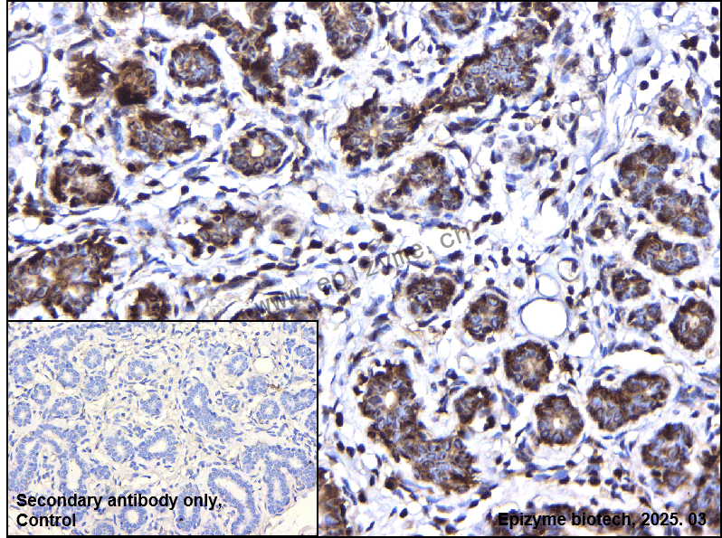 Anti-IKK alpha Rabbit mAb [50K42L84]