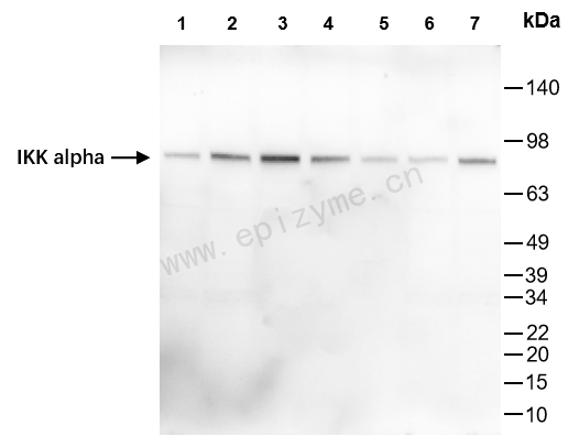 Anti-IKK alpha Rabbit mAb [50K42L84]