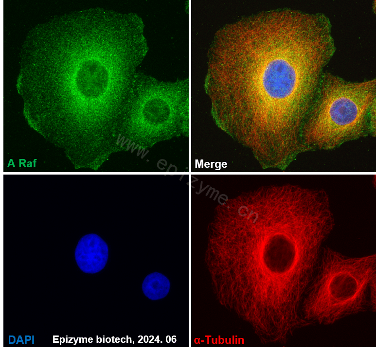Anti-A RAF Rabbit mAb [57L82M51]
