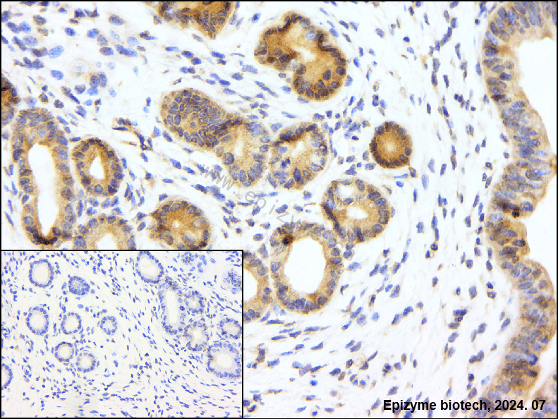 Anti-A RAF Rabbit mAb [57L82M51]