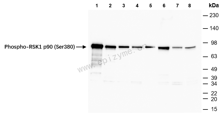 Anti-Phospho-RSK1 p90 (Ser380) Rabbit mAb [53M70K84]