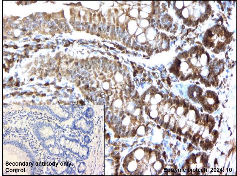 Anti-Phospho-RSK1 p90 (Ser380) Rabbit mAb [53M70K84]