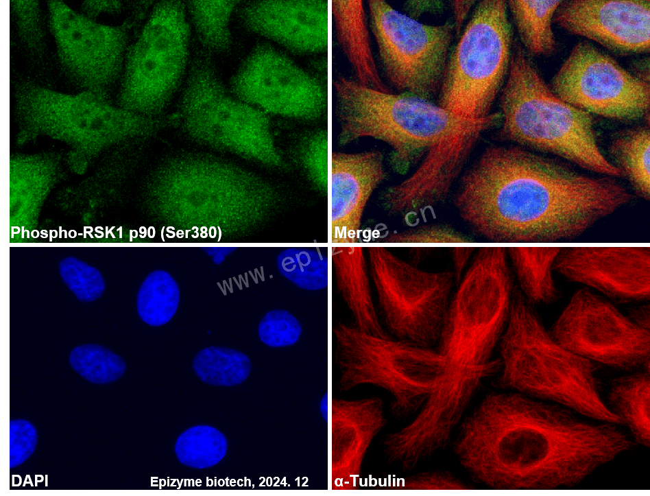 Anti-Phospho-RSK1 p90 (Ser380) Rabbit mAb [53M70K84]