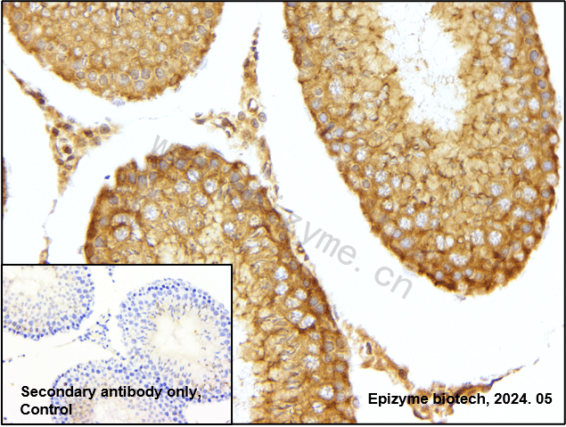 Anti-NF-KB p65 Rabbit mAb [99M06L21]