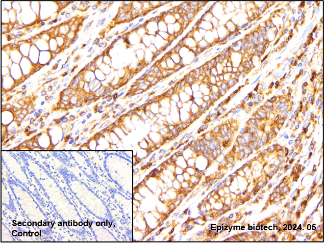 Anti-NF-KB p65 Rabbit mAb [99M06L21]