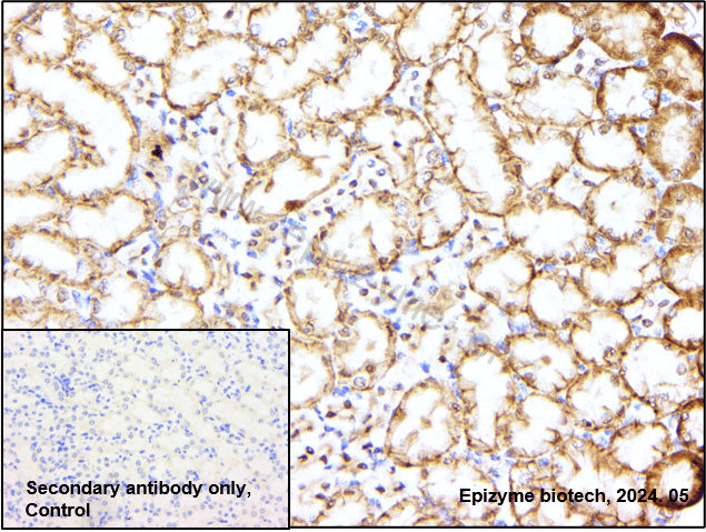 Anti-NF-KB p65 Rabbit mAb [99M06L21]