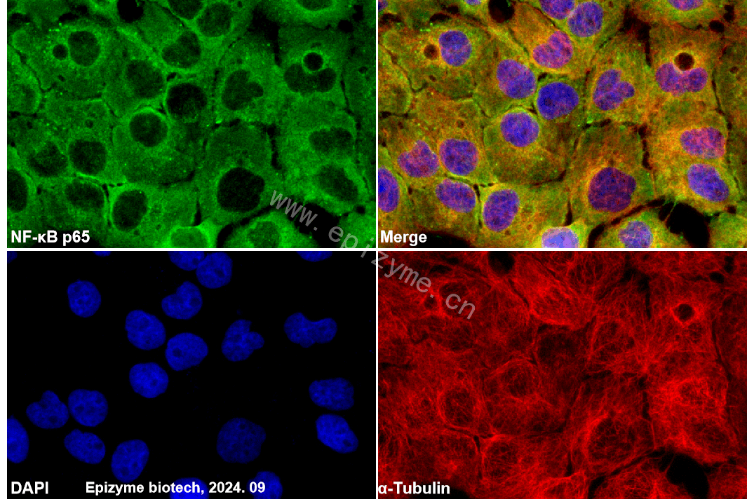 Anti-NF-KB p65 Rabbit mAb [99M06L21]