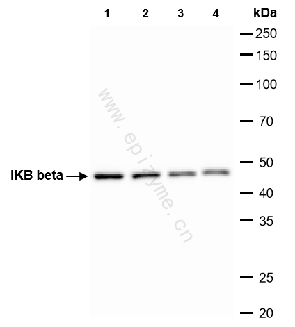Anti-IKB beta Rabbit mAb [54L41M87]