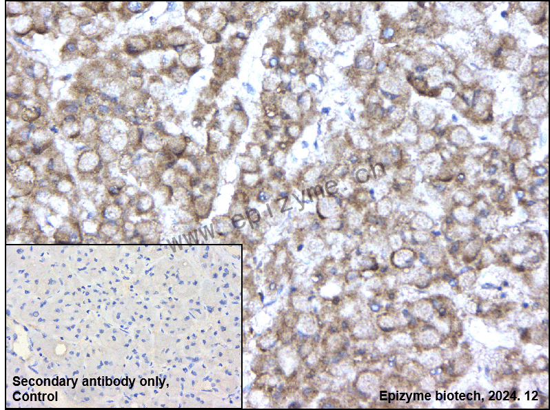 Anti-IKB beta Rabbit mAb [54L41M87]