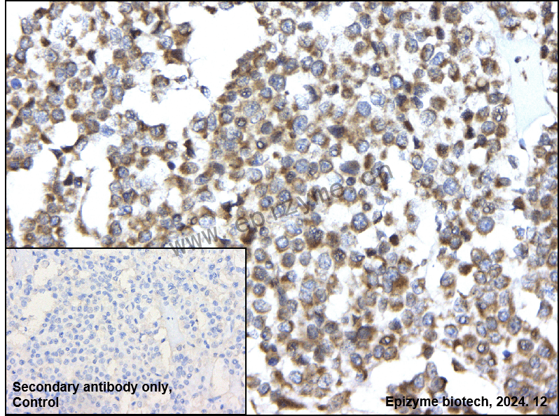 Anti-IKB beta Rabbit mAb [54L41M87]