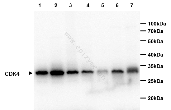 Anti-CDK4 Rabbit mAb [66L24K34]