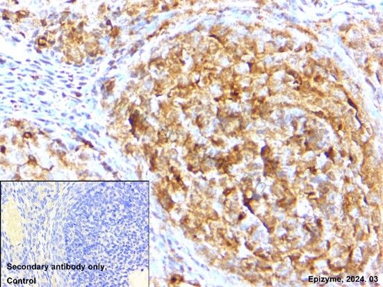 Anti-CDK4 Rabbit mAb [66L24K34]