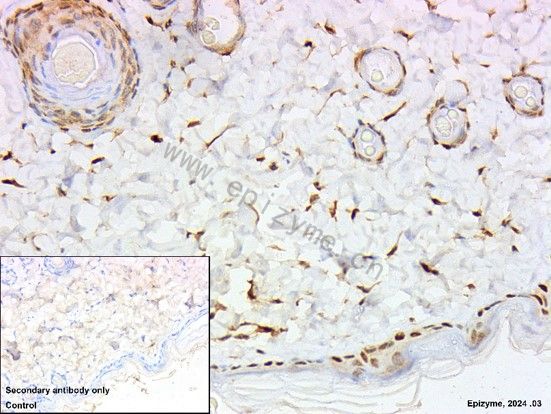Anti-CDK4 Rabbit mAb [66L24K34]