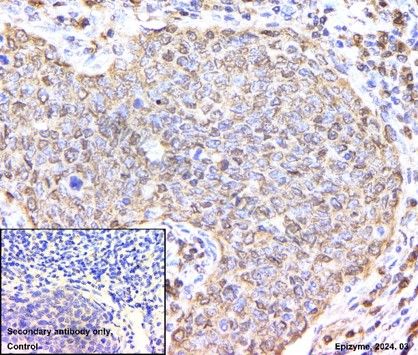 Anti-CDK4 Rabbit mAb [66L24K34]
