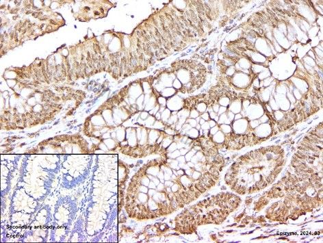 Anti-CDK4 Rabbit mAb [66L24K34]