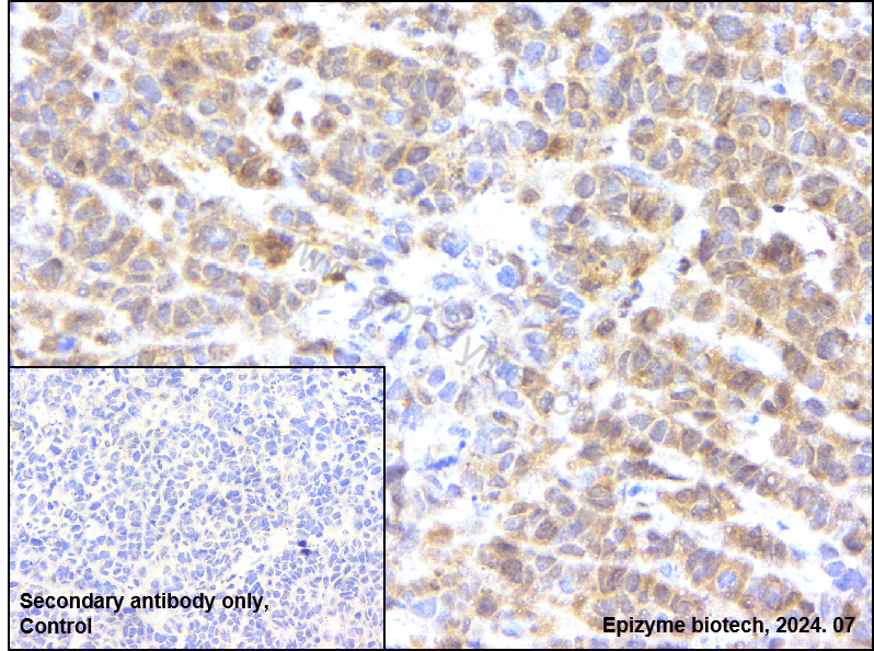 Anti-CDK4 Rabbit mAb [66L24K34]
