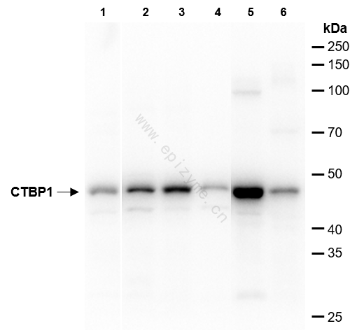 Anti-CTBP1 Rabbit mAb [53M82L55]