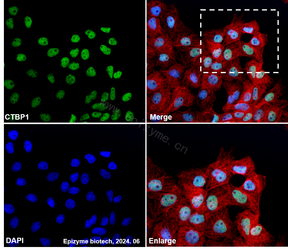 Anti-CTBP1 Rabbit mAb [53M82L55]